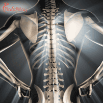 Bone Marrow Stem Cell Therapy in Turkey: Affordable Option for Australian Patients